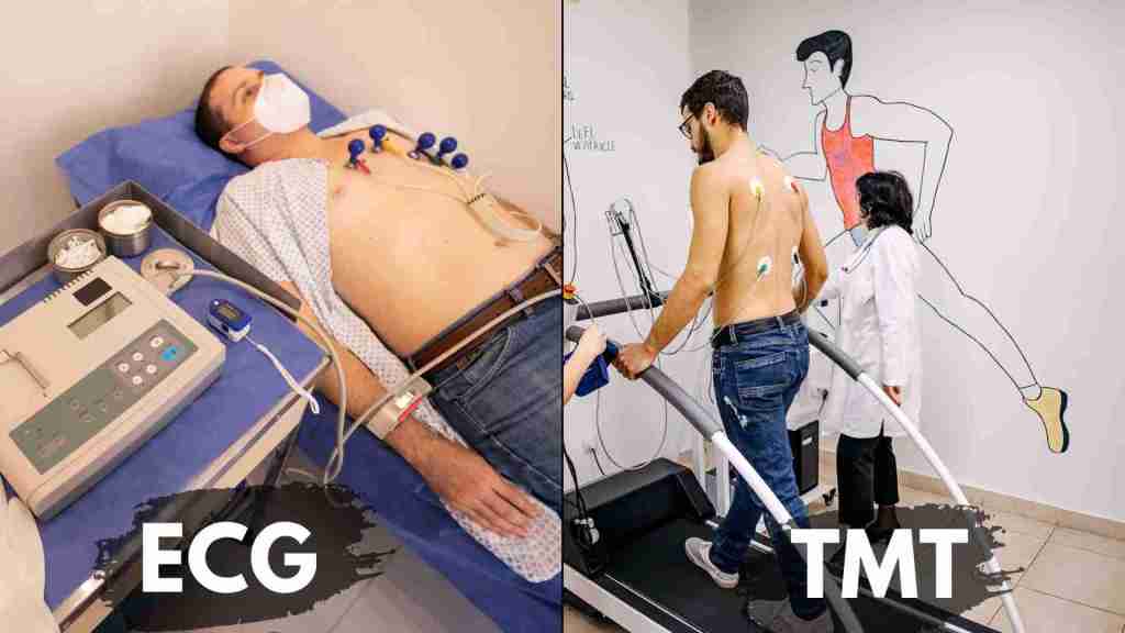 ECG vs TMT Which Is Better For Cardiac Testing