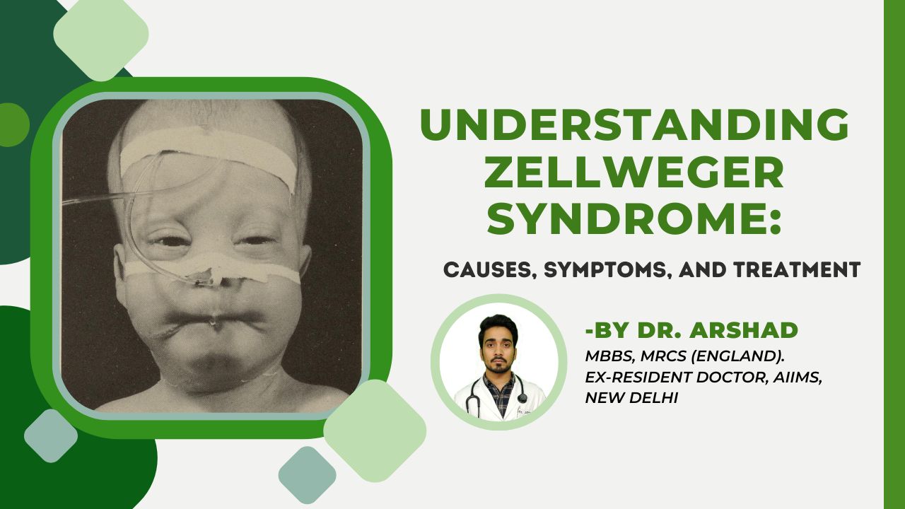 Understanding Zellweger Syndrome Causes Symptoms etc