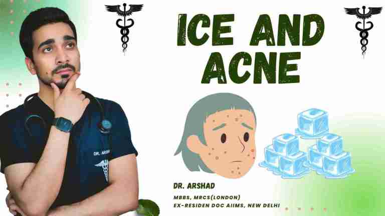 Does Eating Ice cause acne?