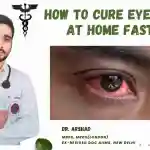 How to cure eye flu at home